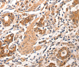 CCL17 Polyclonal Antibody - 3