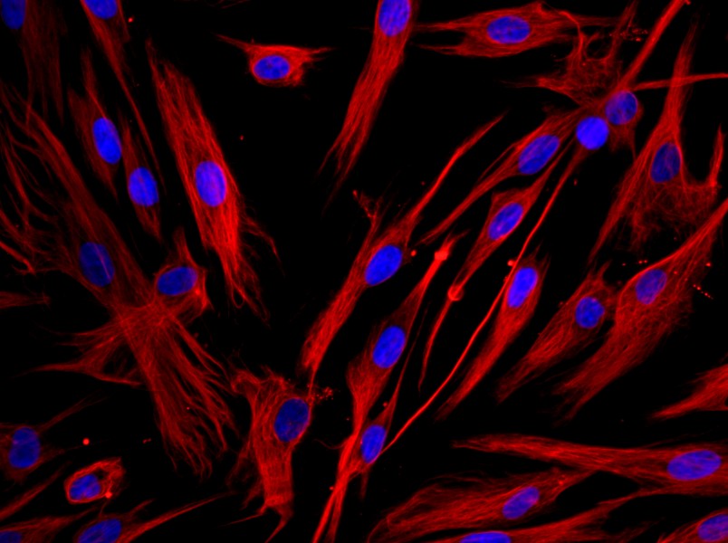 Human Bronchial Fibroblast Complete Medium - 2