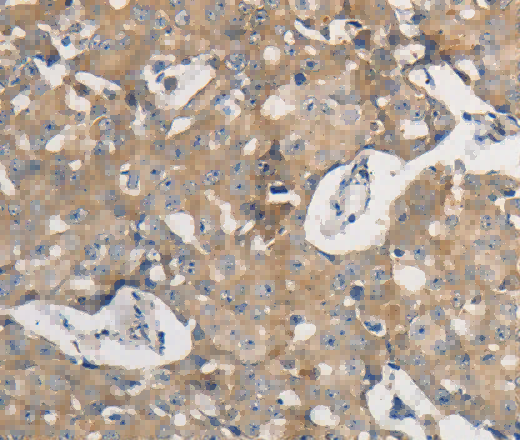 PPP2CB Polyclonal Antibody - 2