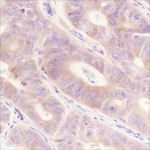 Recombinant CRMP2 Monoclonal Antibody - 3