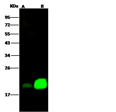 Recombinant NPC2 Monoclonal Antibody - small - 2