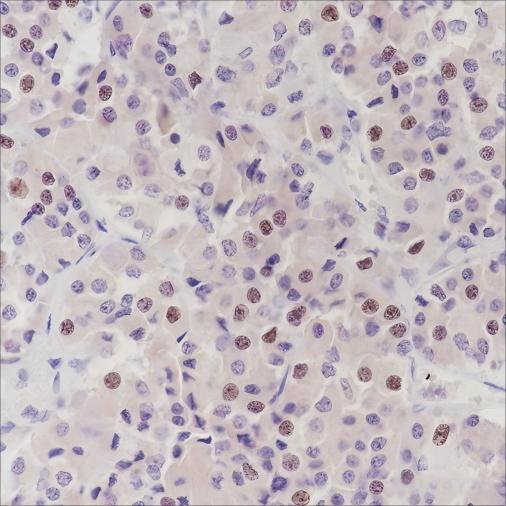 Recombinant PITX2/RGS Monoclonal Antibody-searchlist-1