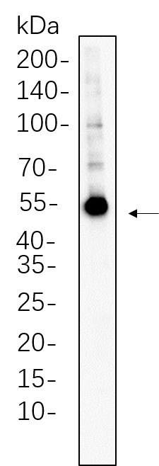 Recombinant Fascin Monoclonal Antibody-searchlist-1