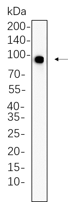 Recombinant Phospho-IGF1R (Tyr1135/1136)/Phospho-Insulin Receptor β (Tyr1150/1151) Monoclonal Antibody-searchlist-1