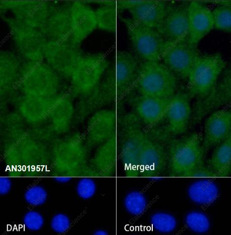 Recombinant RPS3 Monoclonal Antibody - 2