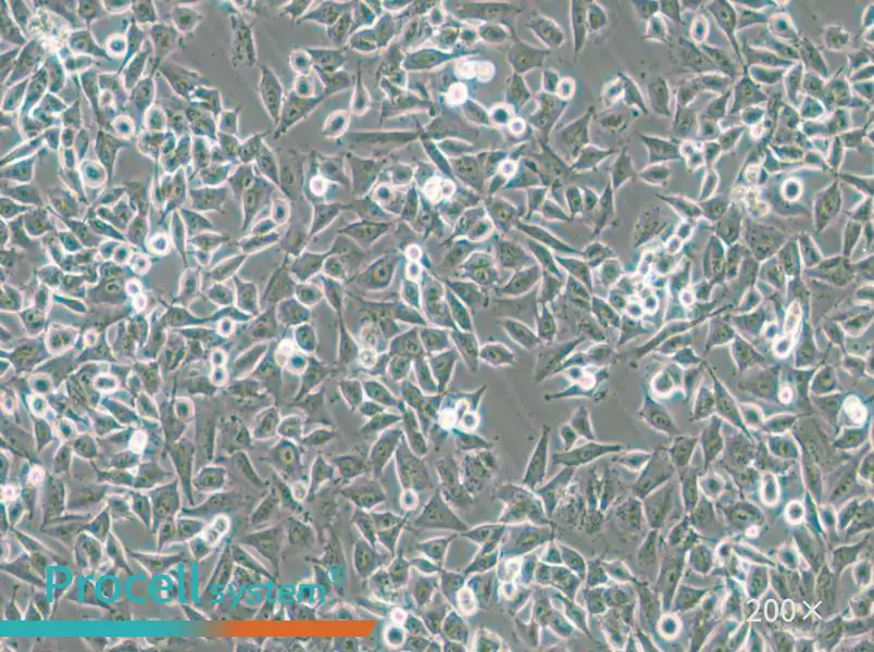 CHP-212 Cell Complete Medium - 4