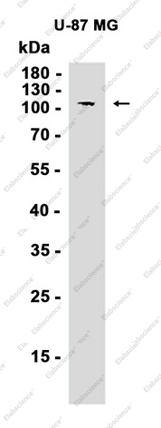 Recombinant MVP Monoclonal Antibody - 1