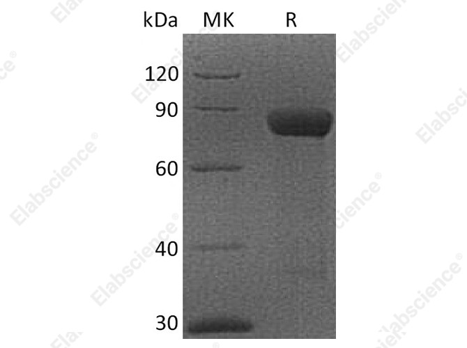 Recombinant Cynomolgus CRTAM/CD355 Protein (Fc Tag) - 1