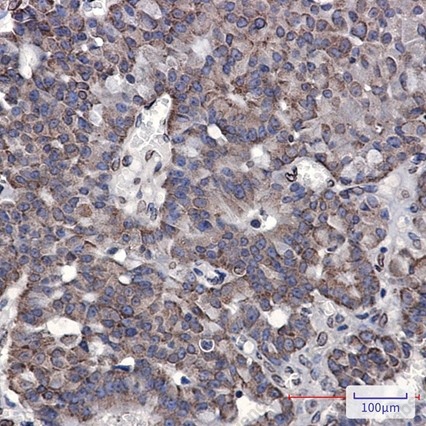 Recombinant RAP80 Monoclonal Antibody - 2