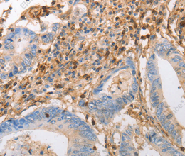 INA Polyclonal Antibody - 2
