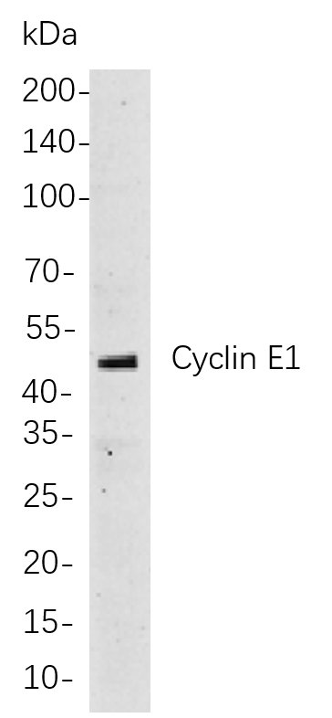 Recombinant Cyclin E1 Monoclonal Antibody-searchlist-1