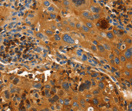 ORM2 Polyclonal Antibody - 3