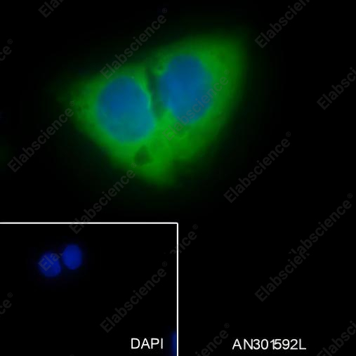 Recombinant LysRS Monoclonal Antibody - 5