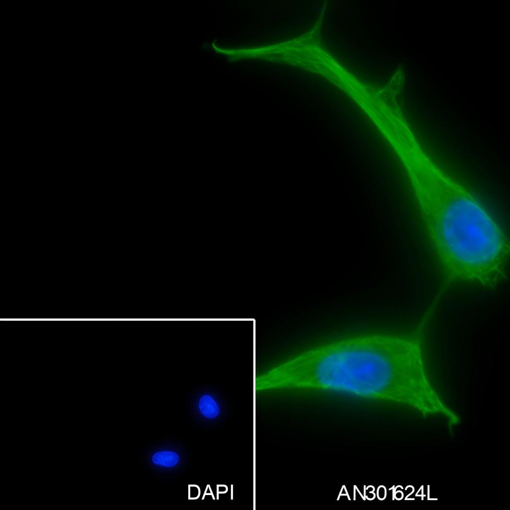 Recombinant PDP1 Monoclonal Antibody - 2