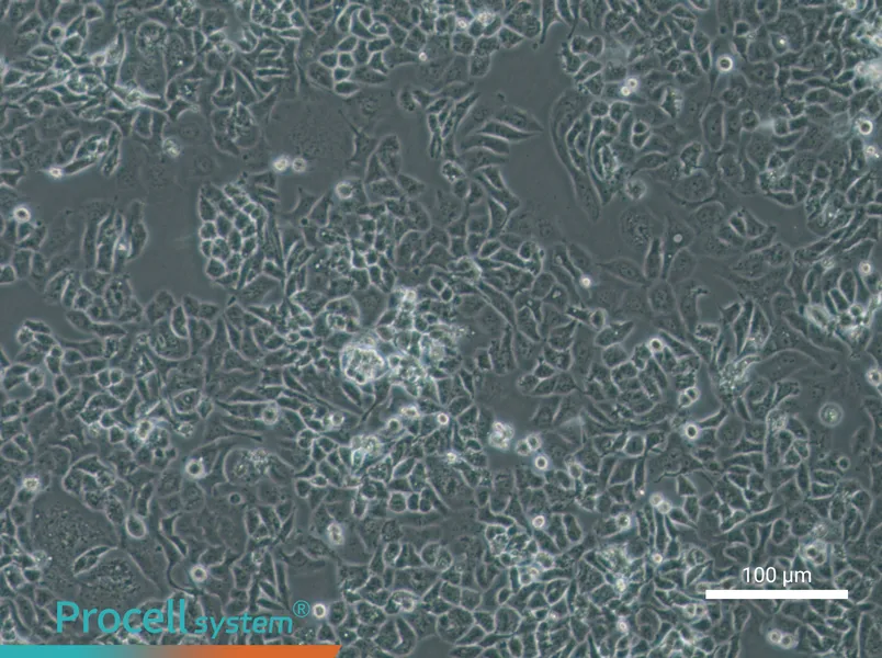 NCI-H522[H522]NCI-H522[H522] - 3