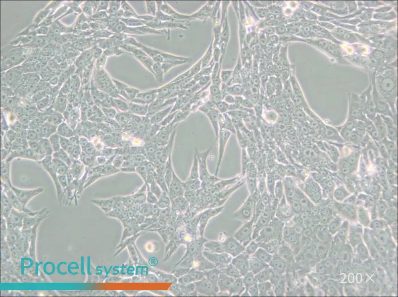 Renca [RenCa] Cell Complete Medium - small - 6