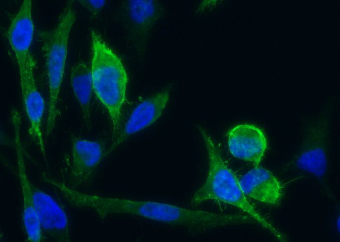 Recombinant CD171/N-CAML1/L1CAM Monoclonal Antibody