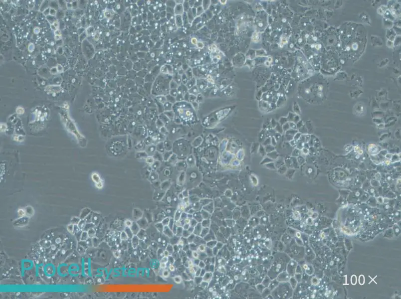 HARA-B Cell Complete Medium - 2