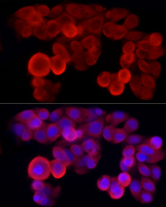 Immunofluorescence analysis of HepG2 cells using NLRP3 Polyclonal Antibody at dilution of 1:50 (40x lens). Blue:DAPI for nuclear staining.