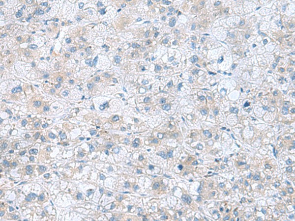 TXNDC12 Polyclonal Antibody - small - 2