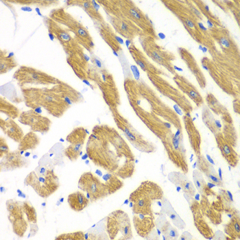 Immunohistochemistry of paraffin-embedded mouse heart using AIMP1 Polyclonal antibody at dilution of 1:100 (40x lens).Perform microwave antigen retrieval with 10 mM PBS buffer pH 7.2 before commencing with IHC staining protocol.