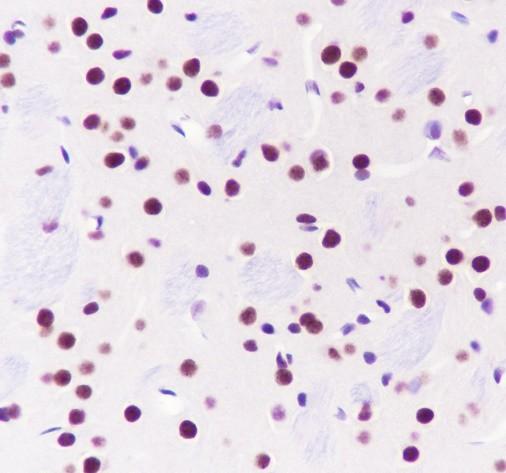 Recombinant TBLR1/TBL1XR1 Monoclonal Antibody - small - 2