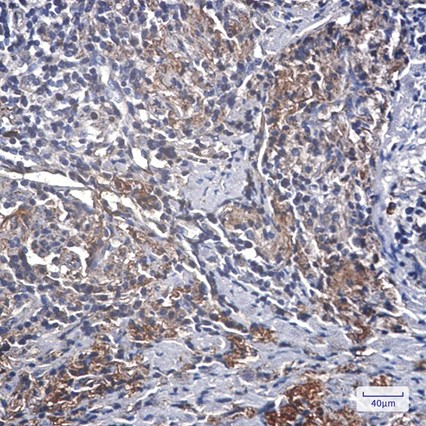 Recombinant IGFBP7 Monoclonal Antibody - 3