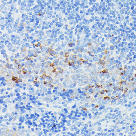 Immunohistochemistry of paraffin-embedded Mouse spleen using IFITM1 Polyclonal Antibody at dilution of 1:100 (40x lens).