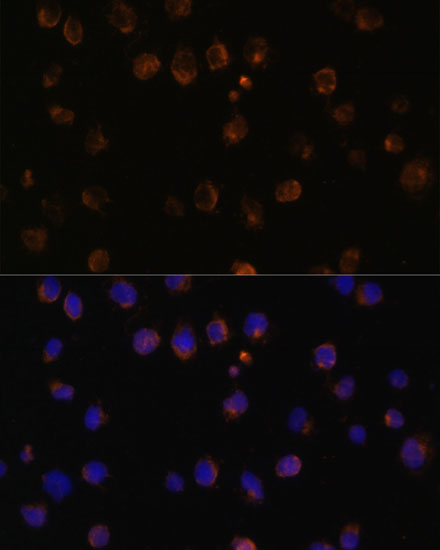 Immunofluorescence analysis of Jurkat cells using MyD88 Polyclonal Antibody at dilution of  1:100 (40x lens). Blue: DAPI for nuclear staining.