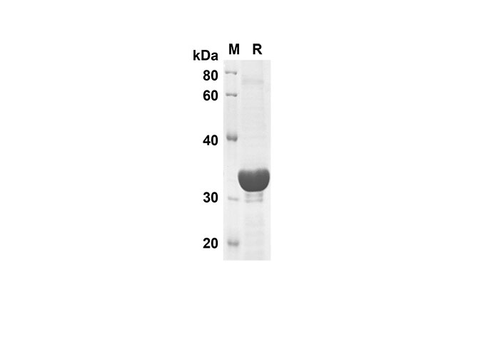 Recombinant Human PD1 Protein(His Tag)-产品推荐-1
