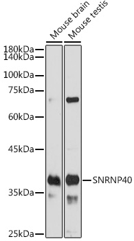 Western blot analysis of extracts of various cell lines using SNRNP40 Polyclonal Antibody at 1:1000 dilution.