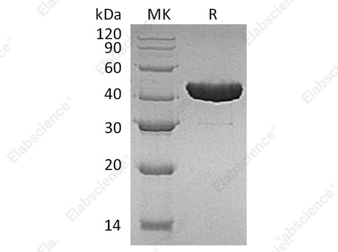 Recombinant E.coli Tryptophan Synthase β Chain/Trp B Protein (His Tag) - 1