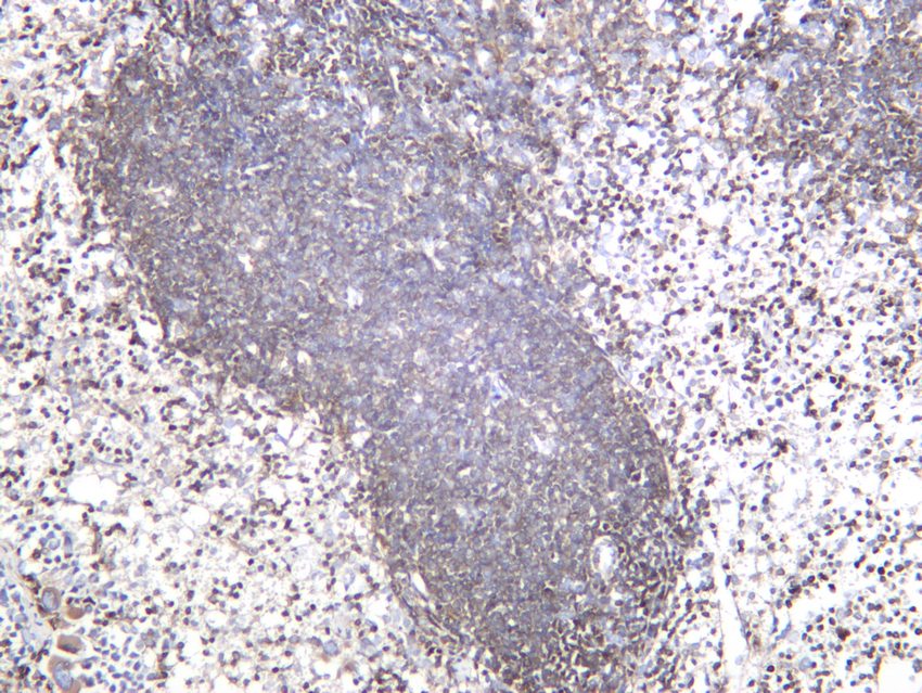 Recombinant Bcl-2 Monoclonal Antibody - small - 7