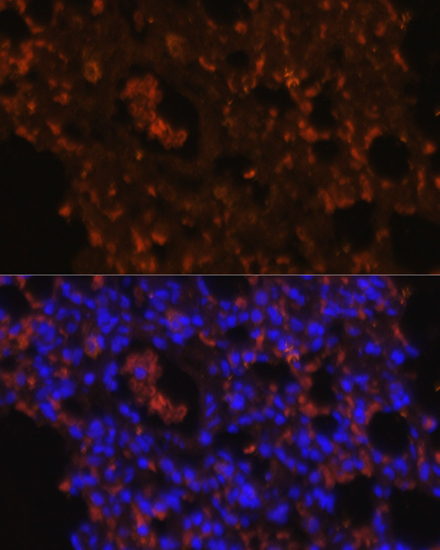 Immunofluorescence analysis of Rat lung using TLR2 Polyclonal Antibody at dilution of 1:100. Blue: DAPI for nuclear staining.