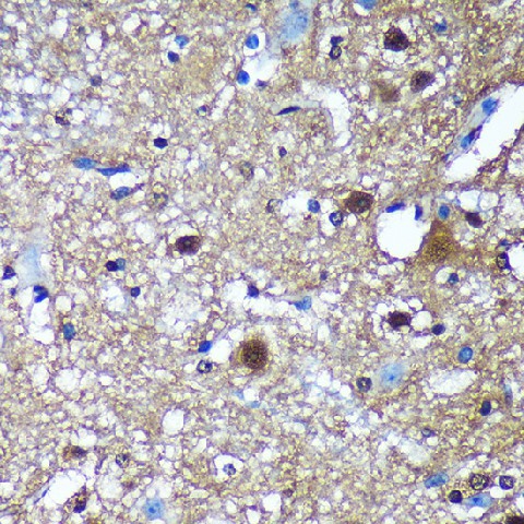 Immunohistochemistry of paraffin-embedded Mouse spinal cord using TSN Polyclonal Antibody at dilution of 1:100 (40x lens).Perform microwave antigen retrieval with 10 mM PBS buffer pH 7.2 before commencing with IHC staining protocol.