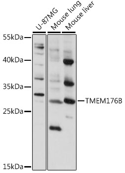 Western blot analysis of extracts of various cell lines using TMEM176B Polyclonal Antibody at 1:1000 dilution.