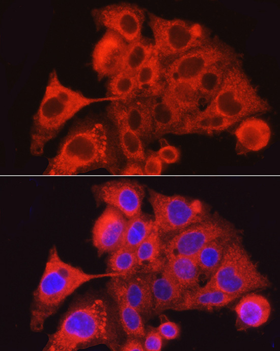 Immunofluorescence analysis of HepG2 cells using PAR2 Polyclonal Antibody at dilution of 1:100 (40x lens). Blue: DAPI for nuclear staining.