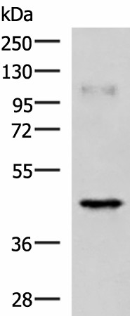 Western blot analysis of Human muscle tissue lysate  using RAB3IL1 Polyclonal Antibody at dilution of 1:1000