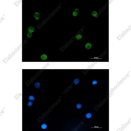 Recombinant SMYD3 Monoclonal Antibody - 2