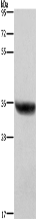 Western Blot analysis of Human placenta tissue  using HSD17B1 Polyclonal Antibody at dilution of 1:700