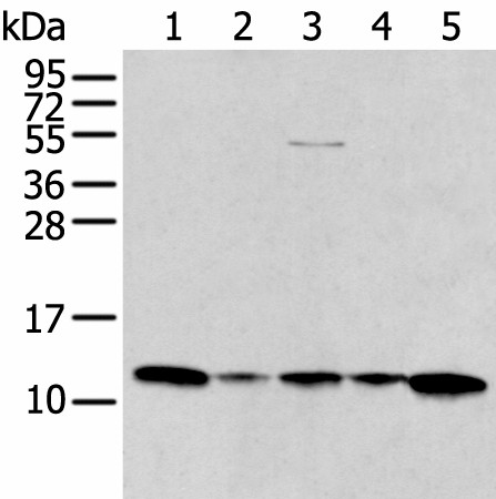 Western blot analysis of A431 Jurkat Lovo and Hepg2 cell Human breast cancer tissue lysates  using CCL1 Polyclonal Antibody at dilution of 1:400