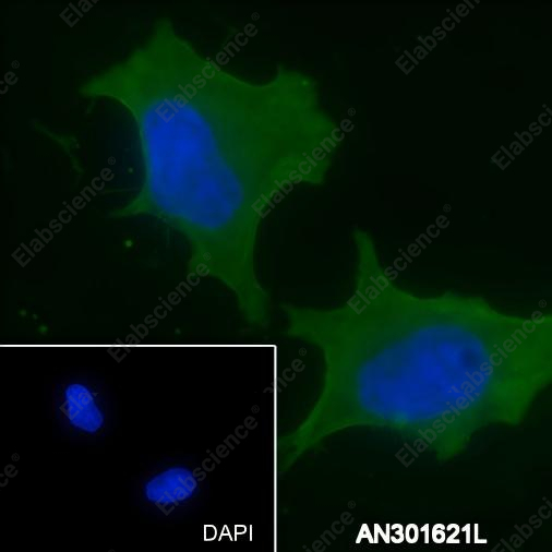 Recombinant PCK2 Monoclonal Antibody - 2