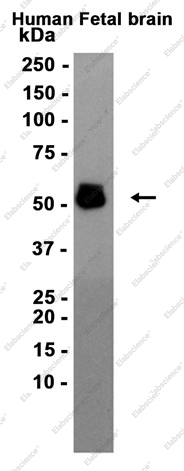 Recombinant Phospho-Tau (Thr181) Monoclonal Antibody - 1