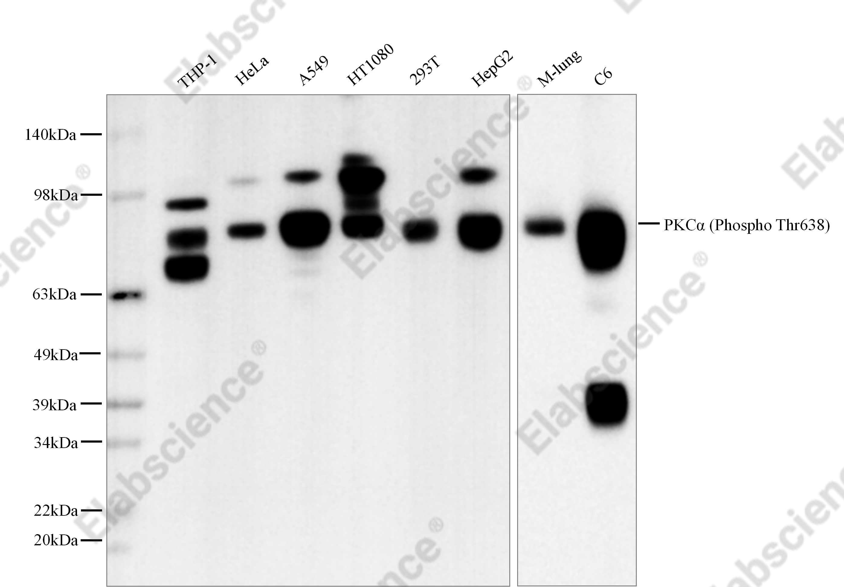 Recombinant Phospho-PKC α (Thr638) Monoclonal Antibody - 1