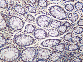 Recombinant ULA1 Monoclonal Antibody - 1