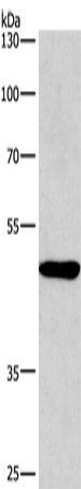 Western Blot analysis of A549 cell using BMP15 Polyclonal Antibody at dilution of 1:266.7