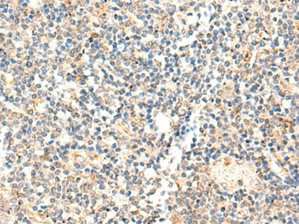 Immunohistochemistry of paraffin-embedded Human tonsil tissue  using ADAMTS2 Polyclonal Antibody at dilution of 1:40(?200)