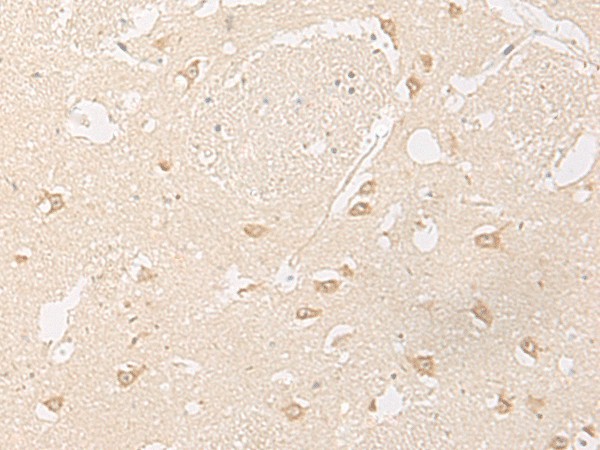 Immunohistochemistry of paraffin-embedded Human brain tissue  using GPR157 Polyclonal Antibody at dilution of 1:60(?200)