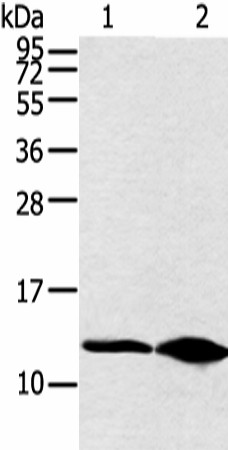 Western blot analysis of Hela cell and human fetal brain tissue  using DYNLL2 Polyclonal Antibody at dilution of 1:250