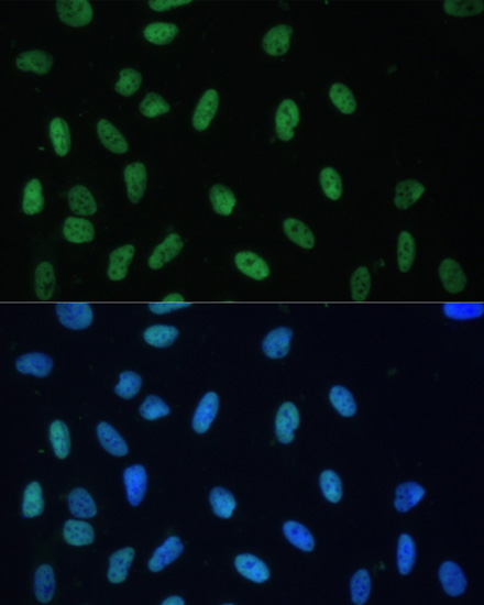 Immunofluorescence analysis of U-2 OS cells using HNRNPD Polyclonal Antibody at dilution of  1:100. Blue: DAPI for nuclear staining.